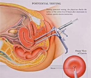 PostCoitalTest